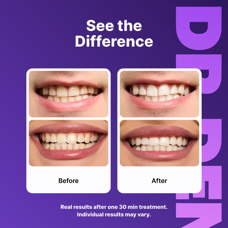 Purple Brightening Strips